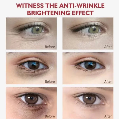 Retinol Eye Cream Collagen Multibalm Stick Reduce Wrinkles Eye Bag Hyaluronic Acid Anti Dark Circle Puffiness Eye Care Products