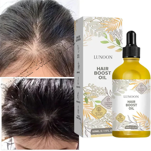 Rosemary Hair Growth Serum Anti Hair Loss Baldness Fast Regrowth Hair Care Oil Repair Damaged Hair Scalp Treatment For Women Men