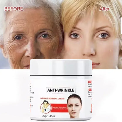 Instant Anti Wrinkle Aging Effect Remove Facial Wrinkles Fade Fine Lines Firming Tightening Face Skin Care Korea Cosmetic