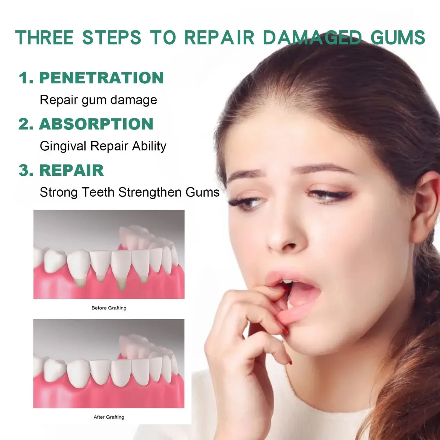 Gingival Repair Drops Quickly Repair Cavities Caries Gingival Swelling Gum Cleaning Care Oral Periodontal Hygiene Remove Stain