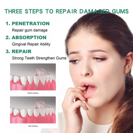 Gingival Repair Drops Quickly Repair Cavities Caries Gingival Swelling Gum Cleaning Care Oral Periodontal Hygiene Remove Stain