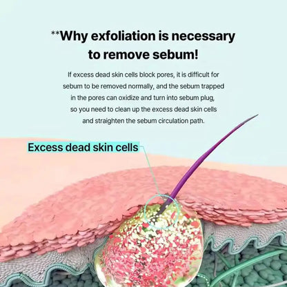 Super Melting Serum Softener Blackhead & Acne Removal Oil-Control Gentle Deep Cleaning Shrinks Pores Facial Repair Serum