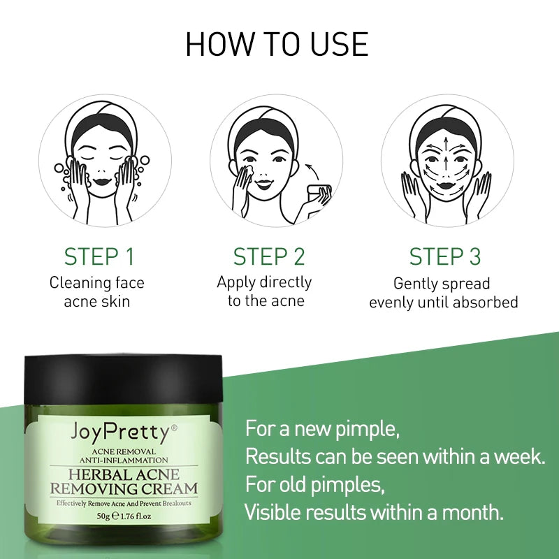 JoyPretty Herbal Day Cream For Acne Skin Care Face Moisturizer Oil Control Pimple Acne Scar Removal Cream Treatment For Women
