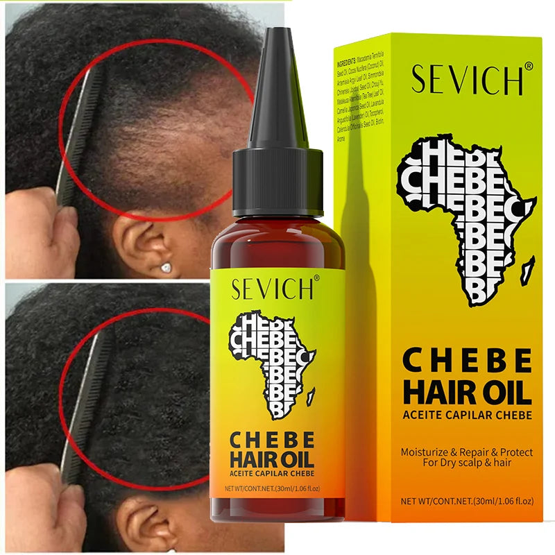 Chebe Hair Growth Oil Fast Hair Growth Chebe Oil Traction Alopecia Anti Break Hair Loss Essential Africa Hair Nourishes Spray