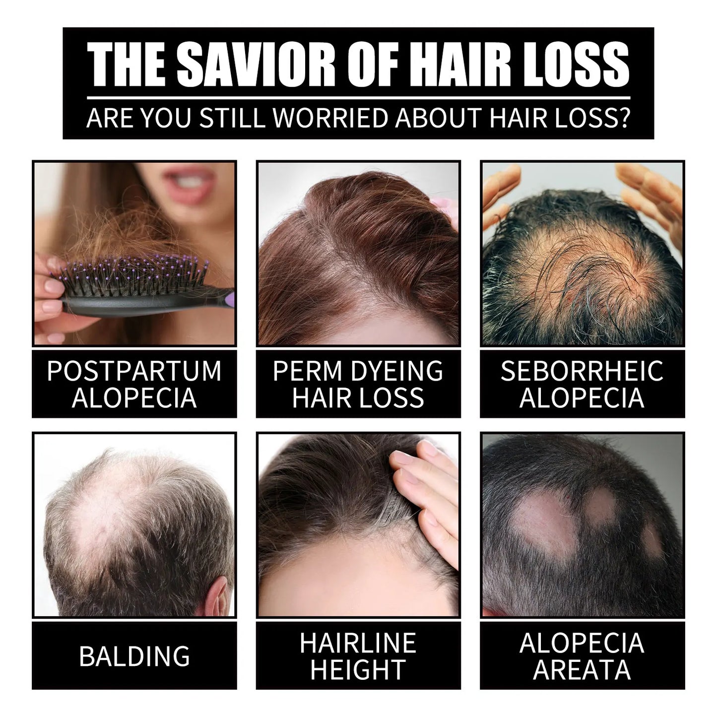 Ouhoe 30ml Collagen Hair Growth Oil for Thinning Hair Anti Hair Loss Deep Nourishing Serum Promotes Regrowth Reduces Shedding