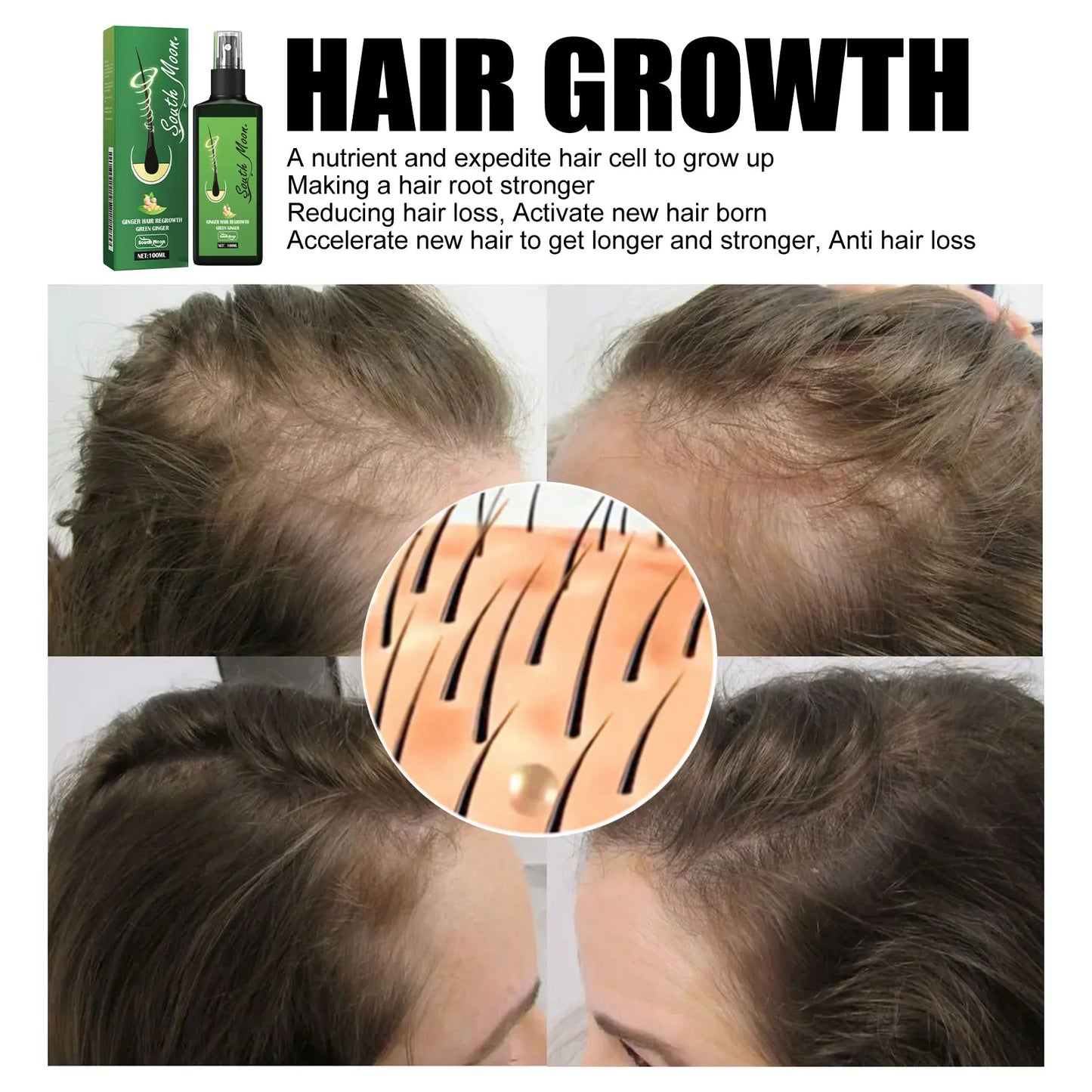 Hair Growth Spray Effective Nourishing Root Hair Thick Growth Liquid Anti Hair Loss Ginger Anti-fall Scalp Massage Care Spray