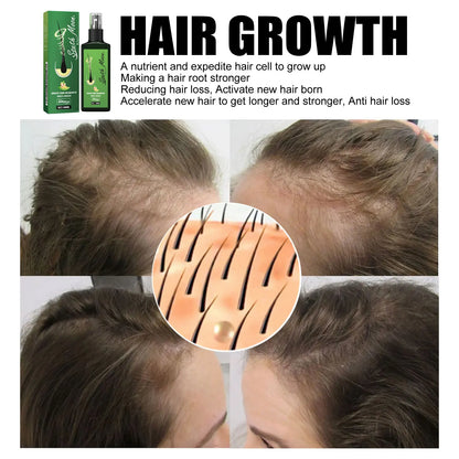 Hair Growth Spray Effective Nourishing Root Hair Thick Growth Liquid Anti Hair Loss Ginger Anti-fall Scalp Massage Care Spray