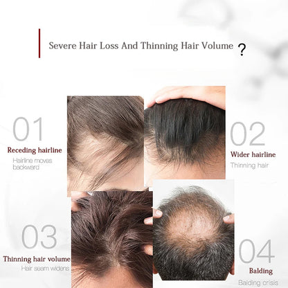 Neon High Frequency Hair Care Machine Electrode HF Wand Replace Red Color Glass Tube Promotes hair growth Theraoy Device