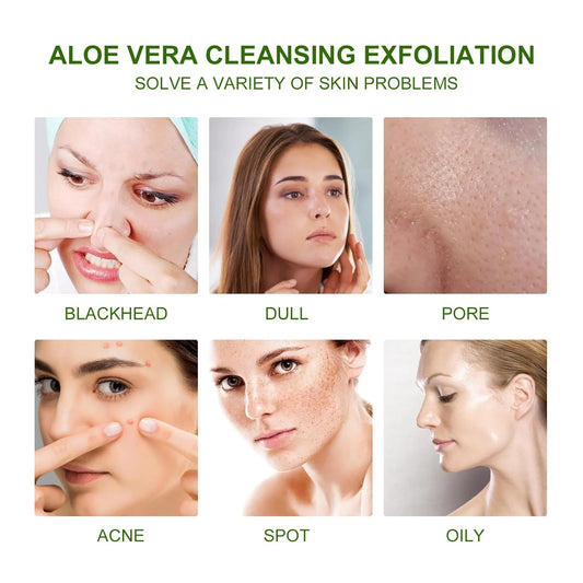 Aloe Vera Facial Exfoliating Scrub Whitening Acne Blackhead Treatment Deep Cleansing Pores Peeling Gel Face Body Skin Care Cream