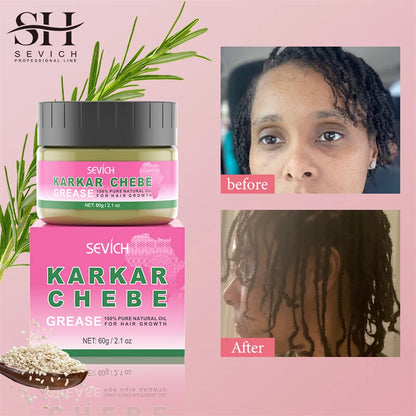 2024 New Super Growth Oil Karkar Regrowth Thicken Oils Chebe Anti-Breakage Essential Oil Serum Rosemary Anti Hair Loss Products