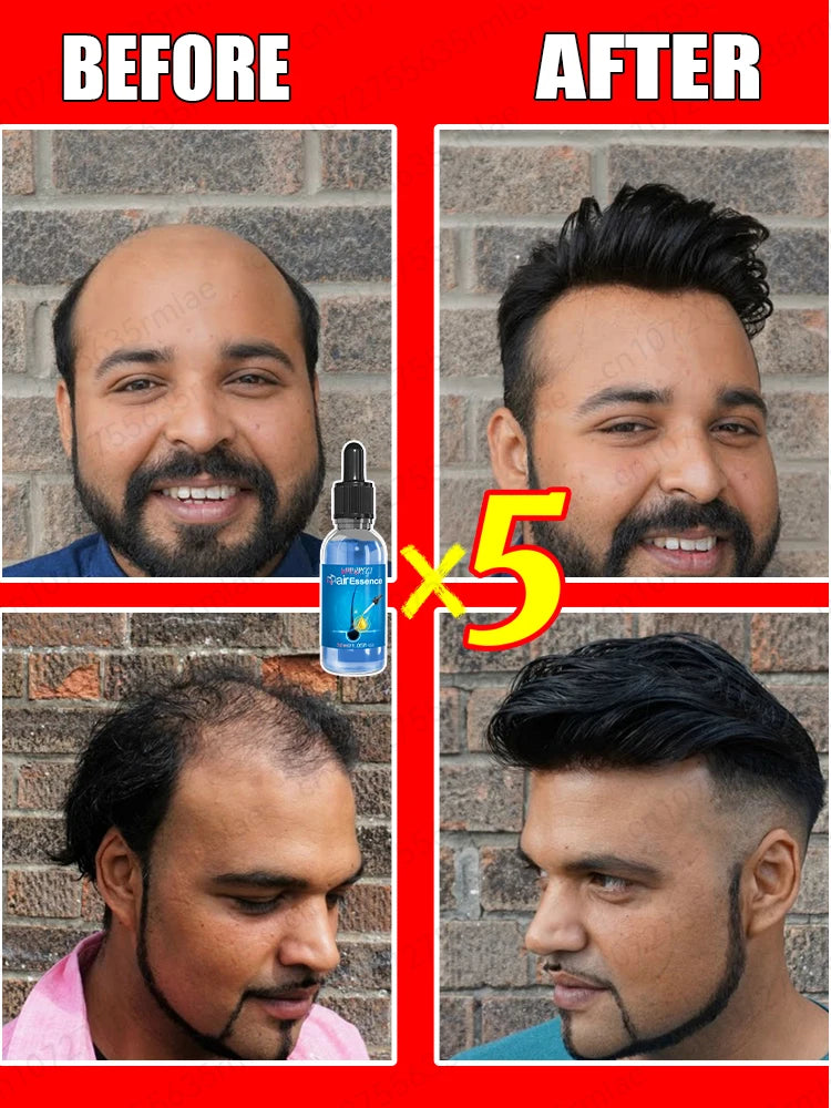 Goodbye baldness. Hair growth essential oils usually contain some special ingredients that can provide sufficient nutrition to h