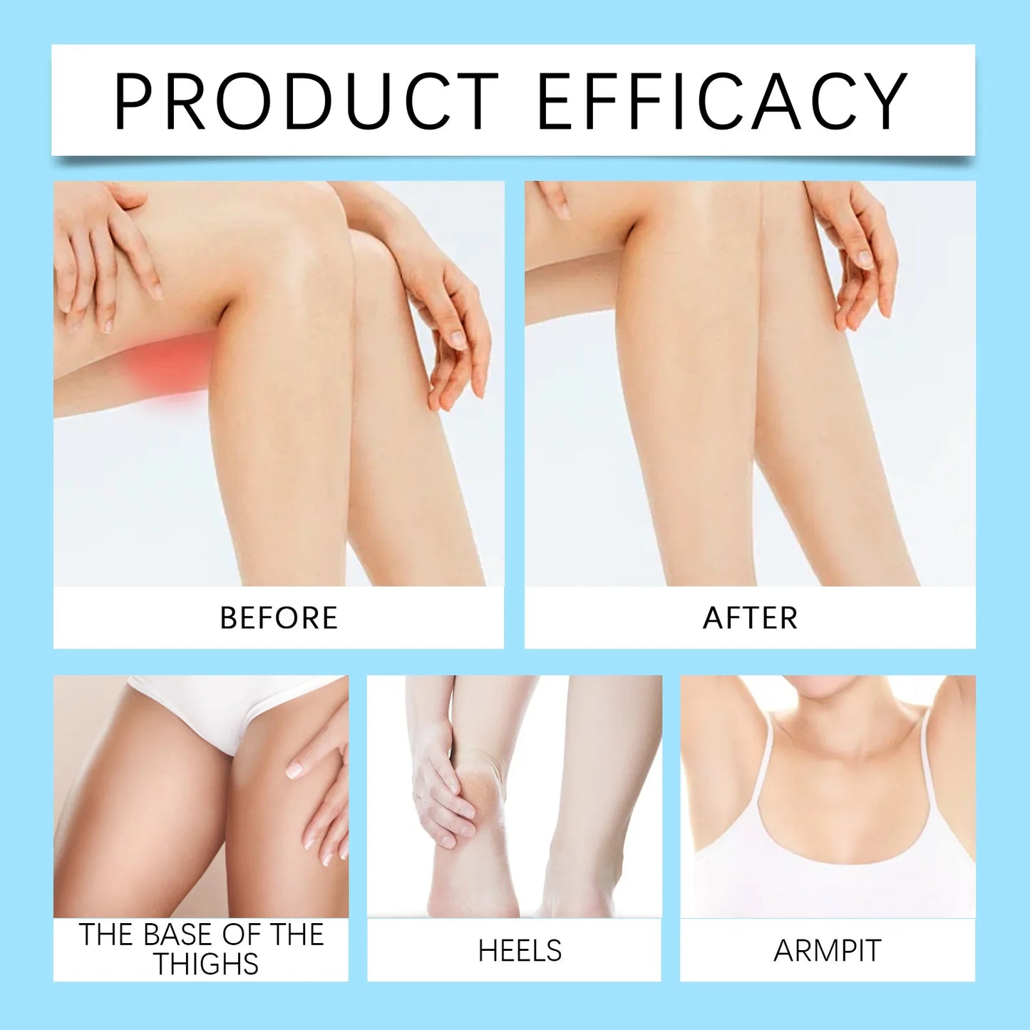 Jaysuing Thigh Smooth Anti-Friction Cream Stick Reduce Friction Reduce Inflammation for Running Cycling Anti Sweat Skin Cream