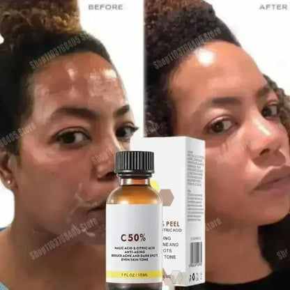 Salicylic Acid Face Facial Peel Neutraliser Face Deep At Home Chemical Peel Exfoliate Refine skin care serum NEW