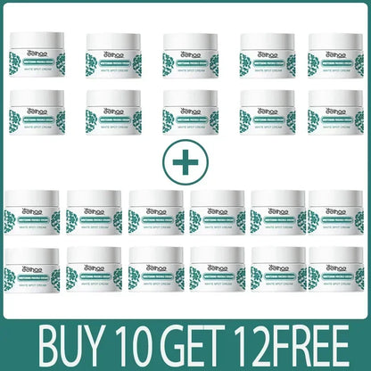 Removal Dark Spots Whitening Freckle Cream Leaving skin looking brighter clearer and more luminous prevent future discoloration