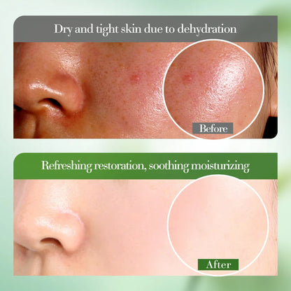 10PCS 50ml Hydrating And Soothing Aloe Vera Gel Moisturizing Soothing Skin Deep Repair Aloe Vera Gel Skin Care Facial Care