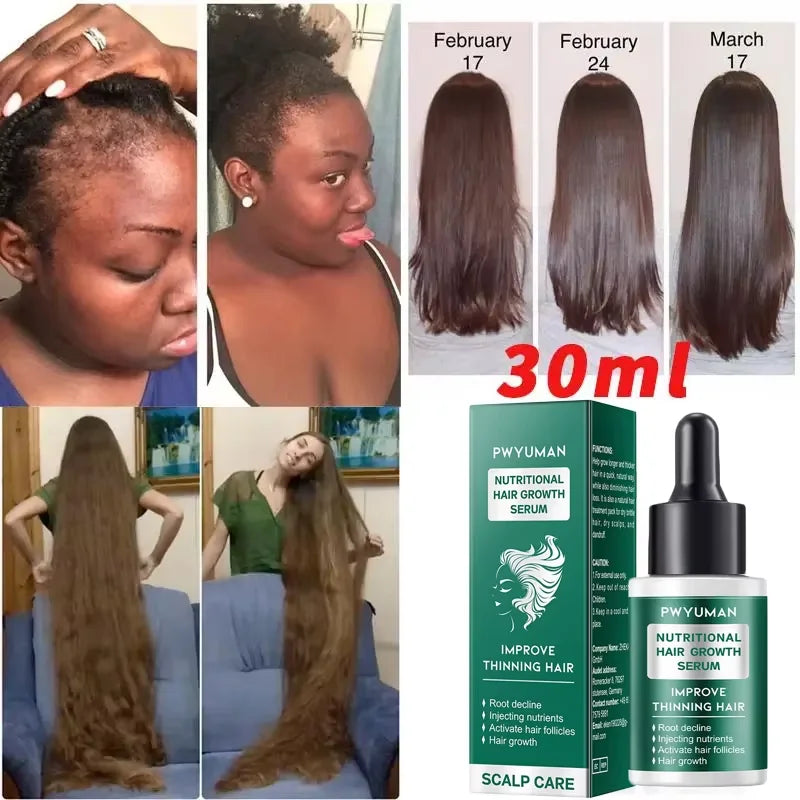 7 Days Fast Hair Growth Serum Prevent Hair Loss Hair Regrowth Essential Oil Repair Damaged Hair Roots Hair Care For Women Men