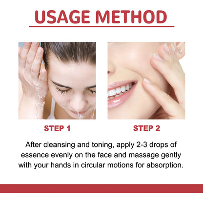 Niacinamide Tranexamic Dark Correcting Essence For Post-Acne Marks Acne Hyperpigmentation And Even Skin Tone Facial CorrectSerum