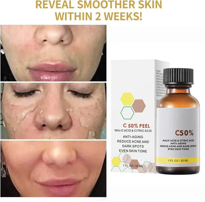 With Malic Acid And Citric Acid For Face Facial Peel 40% Peeling Serum Peeling Serum Chemical Peel Whitening Nourishing Essence