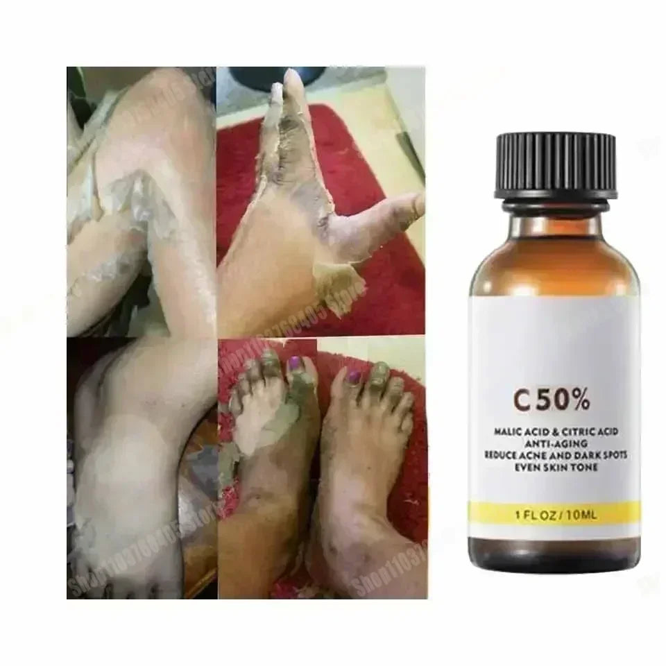 Salicylic Acid Face Facial Peel Neutraliser Face Deep At Home Chemical Peel Exfoliate Refine skin care serum NEW