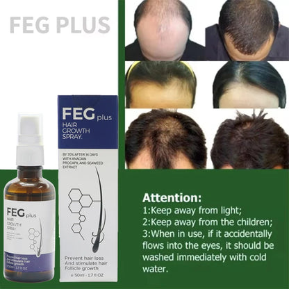 2pcs FEG hair growth spray original Organic Anti Hair Loss Hair Growth Treatment Oil For Thicker Long Hair -50ML