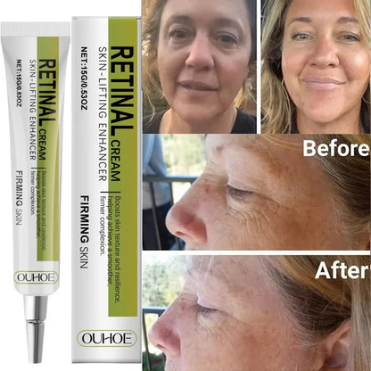 Retinol Cream Tightening Anti Wrinkle Improve Sagging Moisturizing Smoothing Lightening Firming Radiant Fine Lines Removal Cream