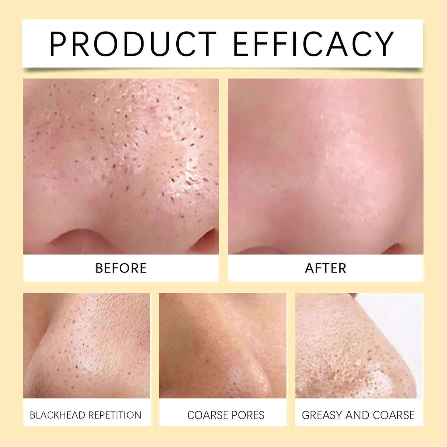 60pcs+30g Blackhead Tearing Nose Mask Absorbs Oil Dirt Gently And Effectively Remove Blackheads Whiteheads Short Time Aloe Vera