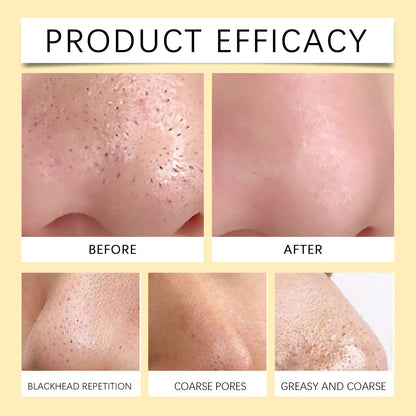 60pcs+30g Blackhead Tearing Nose Mask Absorbs Oil Dirt Gently And Effectively Remove Blackheads Whiteheads Short Time Aloe Vera