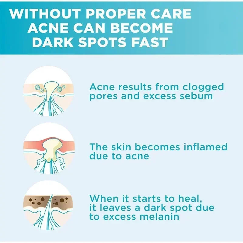 Skin Texture | Pore Refining Resurfacing, Brightening Facial Serum with Retinol and Niacinamide Non-Comedogenic