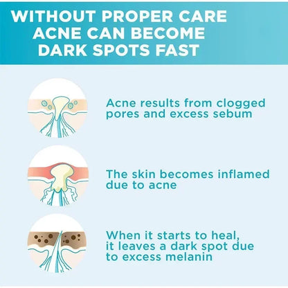 Skin Texture | Pore Refining Resurfacing, Brightening Facial Serum with Retinol and Niacinamide Non-Comedogenic