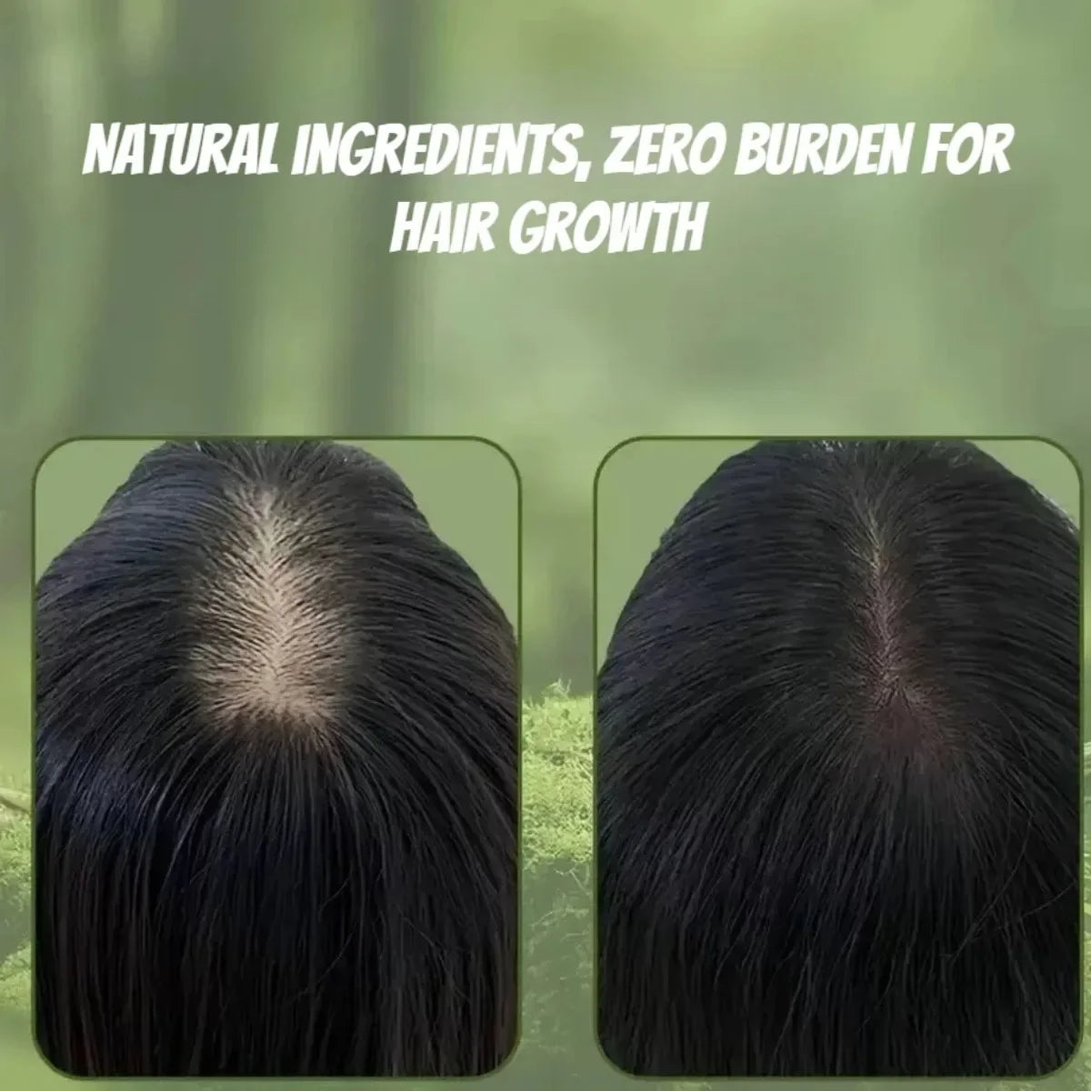 Minimalist cleaning and care approach, reshaping the strong and resilient vitality of hair roots
