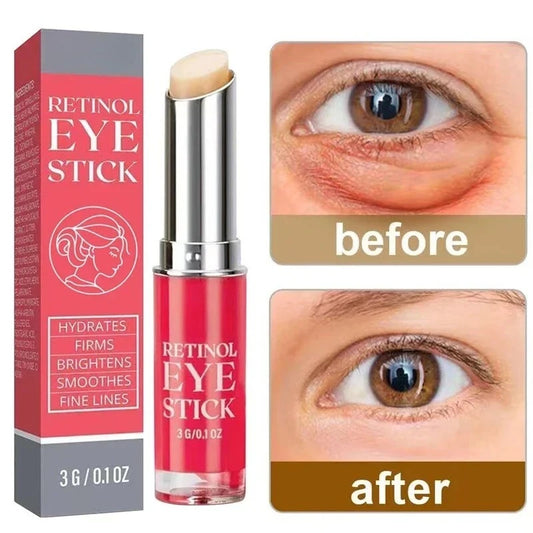 Anti-Wrinkle Eye Cream Retinol Remove Eye Bags Dark Circles Anti Aging Lifting Firming Whitening Moisturizing Brighten Skin Care