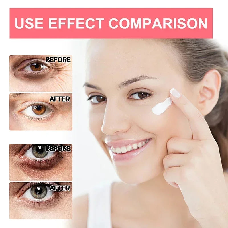 Retinol Anti Wrinkle Eye Cream Get Rid Of Puffy Dark Circles Lift Eye Area  Preventing Puffiness Whitening Moisturizing Skincare