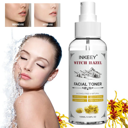 Summer Witch Hazel Toner - Refreshing, Pore Minimizing, with Aloe Vera, Rose Water, for Balanced & Hydrated Skin, Suitable for A