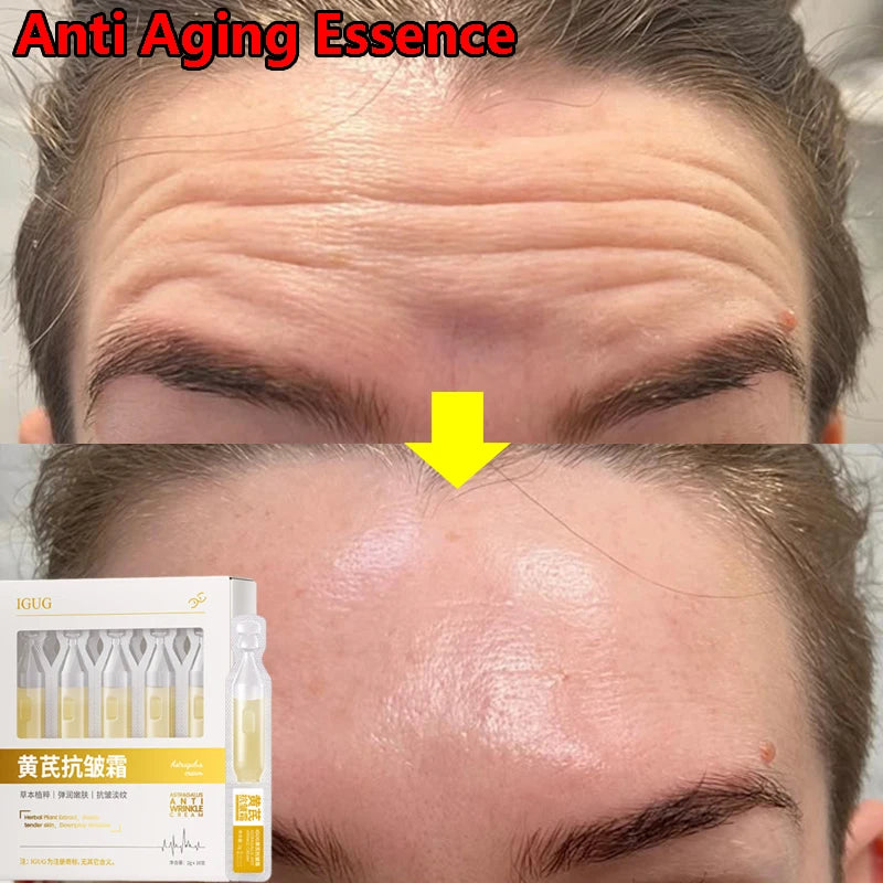 Astragalus Instant Wrinkle Remover Essence Fade Fine Lines Face Serum Anti Aging Firming Lifting Whitening Korean Skin Care