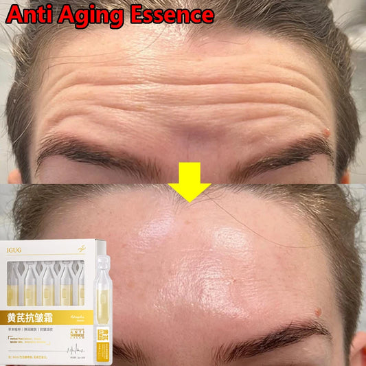 Astragalus Instant Wrinkle Remover Essence Fade Fine Lines Face Serum Anti Aging Firming Lifting Whitening Korean Skin Care