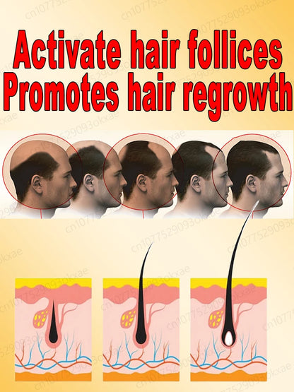Double hair growth essential oil, the result of plant essence research, say goodbye to baldness and hair loss, without harming t