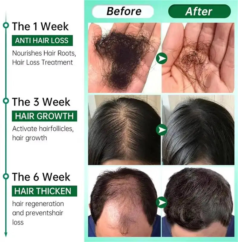 Major Hair Growth Essence Tough Care Hair Improve Dry Scalp Wash Free Hair Care Nourishment Oil Anti Alopecia Hair Care