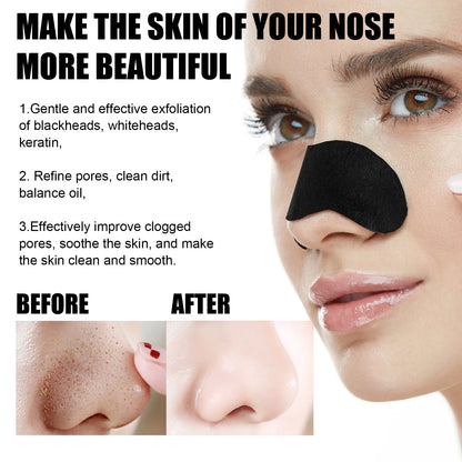 10/50/100Pcs Blackhead Remover Mask Unisex Deep Cleansing Nose Strips for Acne Shrink Pore Skin Care Strips Nose Sticker Cleaner
