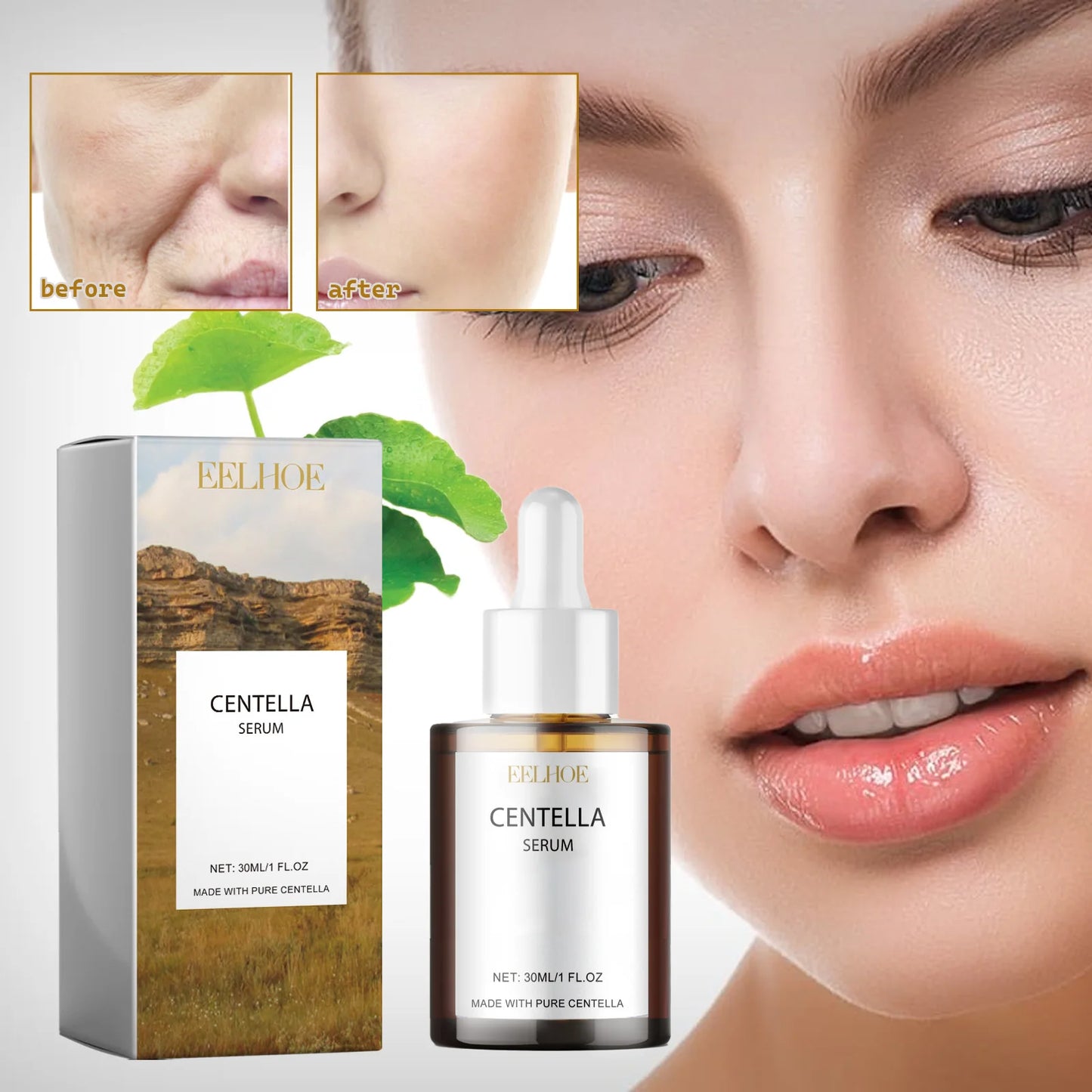 Centella Repair Facial Redness Serum Removal Sensitive Skin Smoothing Rejuvenation Skin Brightening Whitening Korean Cosmetics