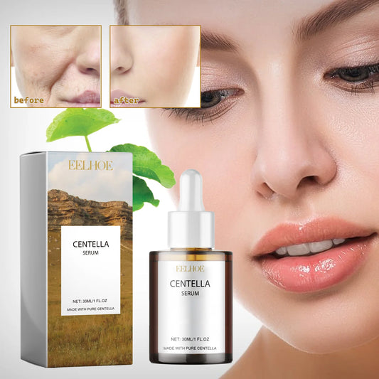 Centella Repair Facial Redness Serum Removal Sensitive Skin Smoothing Rejuvenation Skin Brightening Whitening Korean Cosmetics