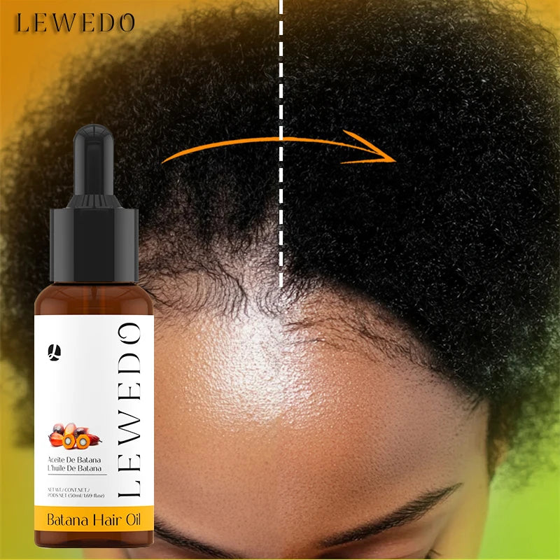 Lewedo Natural Batana Hair Growth Oil Set For Men Women Reduce Hair Loss Treatment Serum Nourish Scalp Anti-Breakage Hair Mask