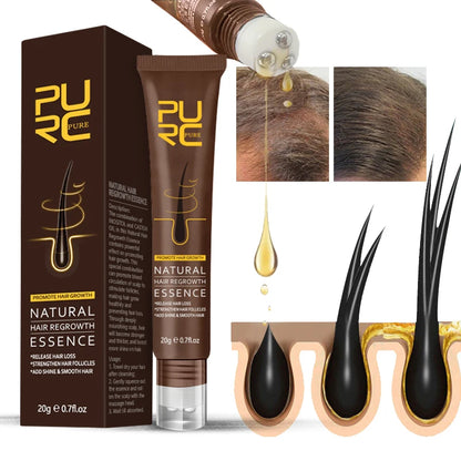 PURC Natural Hair Regrowth Essence Ginger Hair Growth Serum Hair Loss Treatment Hair Growth Products for Men Women Hair Care