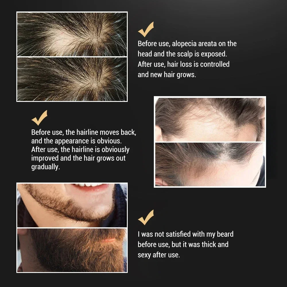 Beard Growth Serum Spray Hair Growing Essential Oil Fast Styling Thicker Longer Fuller Beard Softening Moisturizing Beard Liquid