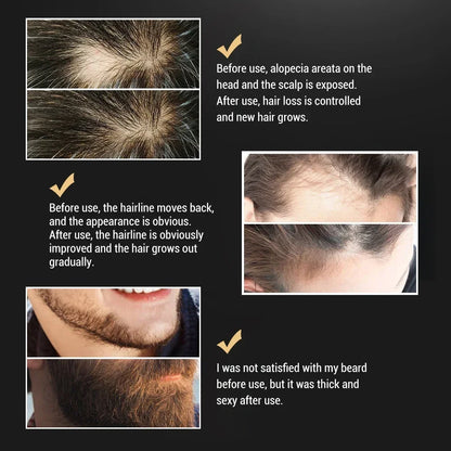 Beard Growth Serum Spray Hair Growing Essential Oil Fast Styling Thicker Longer Fuller Beard Softening Moisturizing Beard Liquid