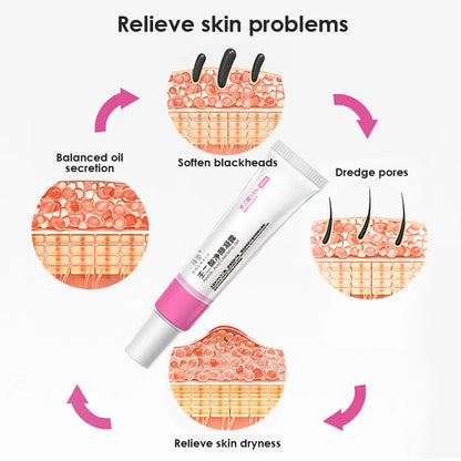 30ml 15% Azelaic Acid Purifying Gel Salicylic Acid  Pore Shrinking Cream Acne Treatment Blackhead Removal Face Deep Cleaning Gel