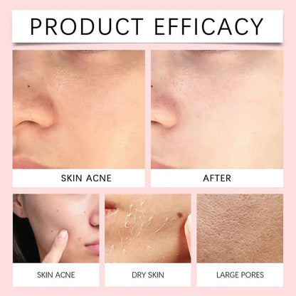 Himalayan Salt Centella Asiatica Cleanser Deep Cleansing Foam Removes Impurities Gentle Refreshing Facial Cleanser 114g