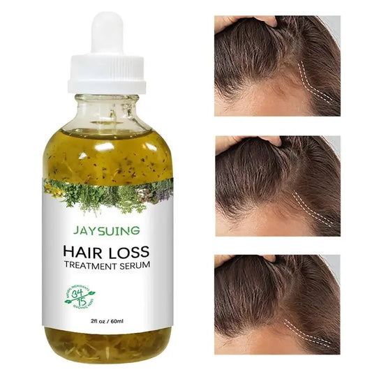 Hair Growth Essence Oil Hair Loss Oil Repair 60ml Hairs Growth Serums Dry Damaged Hairs Care Oils for Women  Men All Hair Types