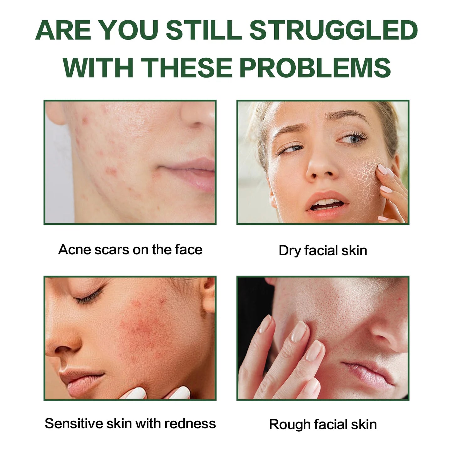 Aloe Vera Gel Natural Moisturing Hydration and Repair Face Cream Shrink Pores Soothing Redness Face Skin Care 40ML