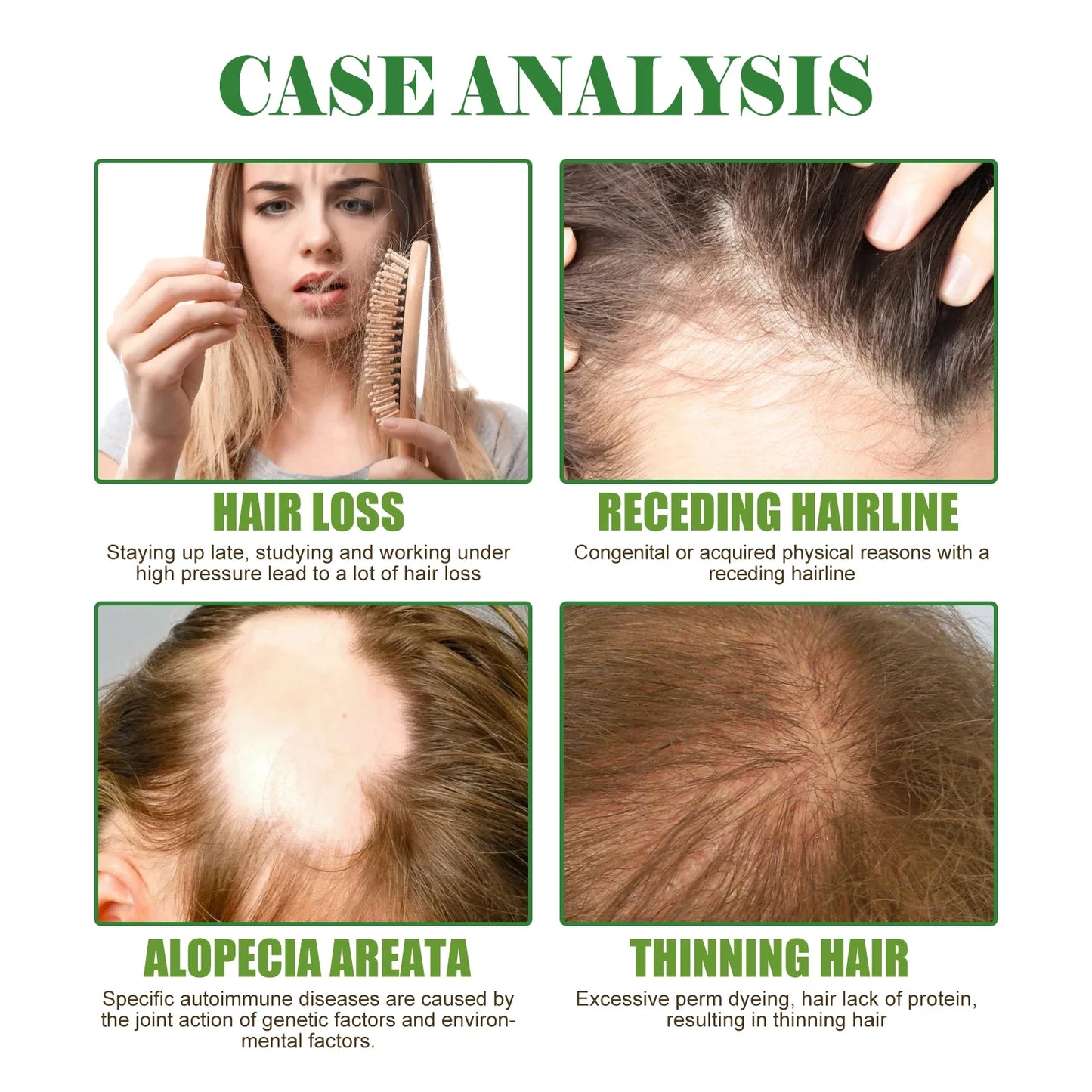 Rosemary Hair Care Essential Oil Prevent Hair Loss Reduct Dryness Frizz Nourish The Scalp Stabiliz The Roots Hair Care Products