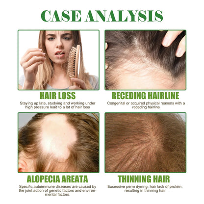 Rosemary Hair Care Essential Oil Prevent Hair Loss Reduct Dryness Frizz Nourish The Scalp Stabiliz The Roots Hair Care Products